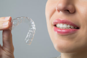 clear braces - invisalign