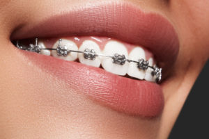 orthodontics